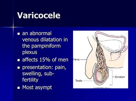 small soft lumo testes|varicocele testicle lump.